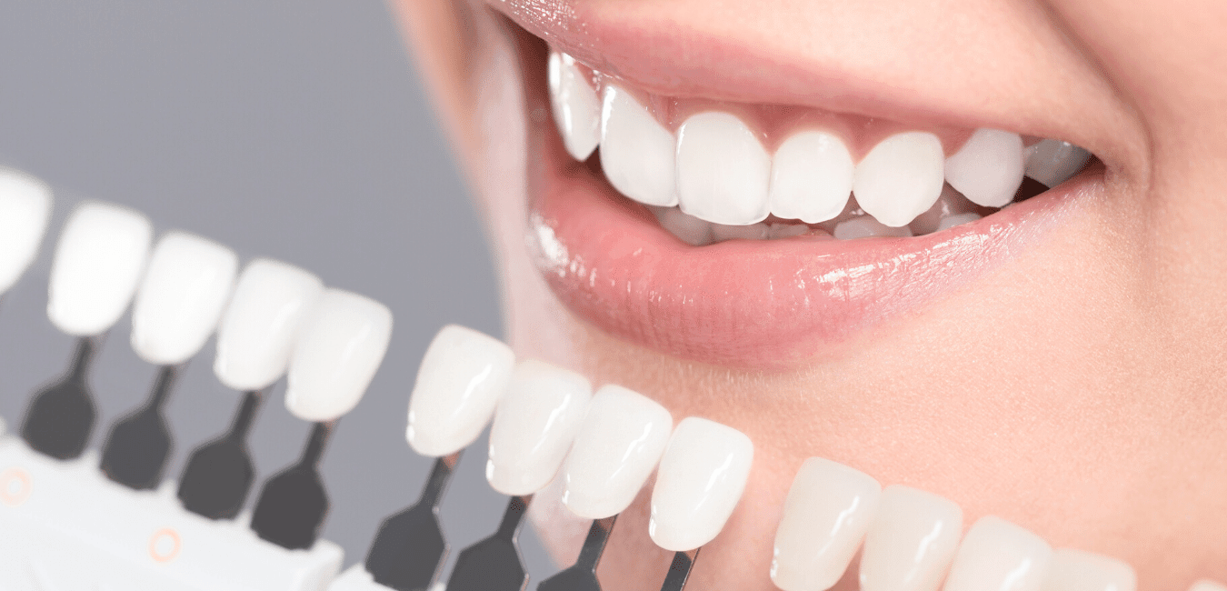 Profesjonelle tannblekingsprodukter